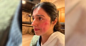 Divya Khosla Kumar suffers an injury while shooting for her upcoming project!