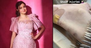 Divya Khossla Suffers Foot Injury on the Sets of Her Upcoming Film, Shares Pictures on Social Media